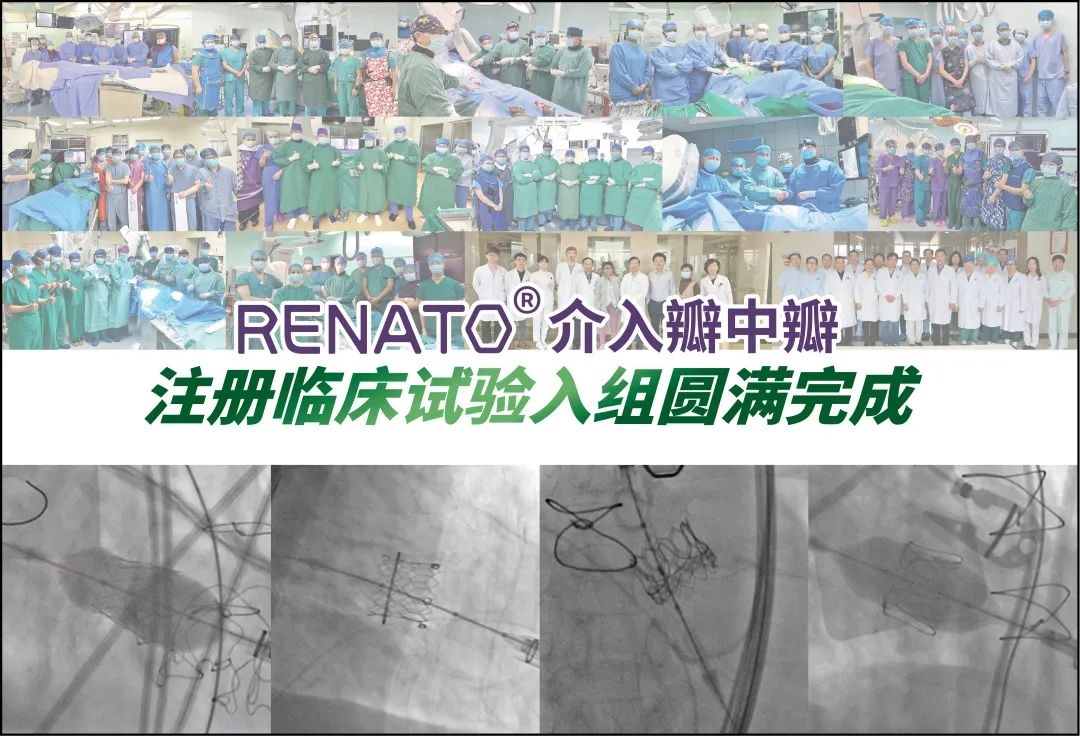 中國首個介入瓣中瓣臨床試驗完成入組：佰仁醫(yī)療Renato?球擴(kuò)瓣全組注冊患者獲成功救治